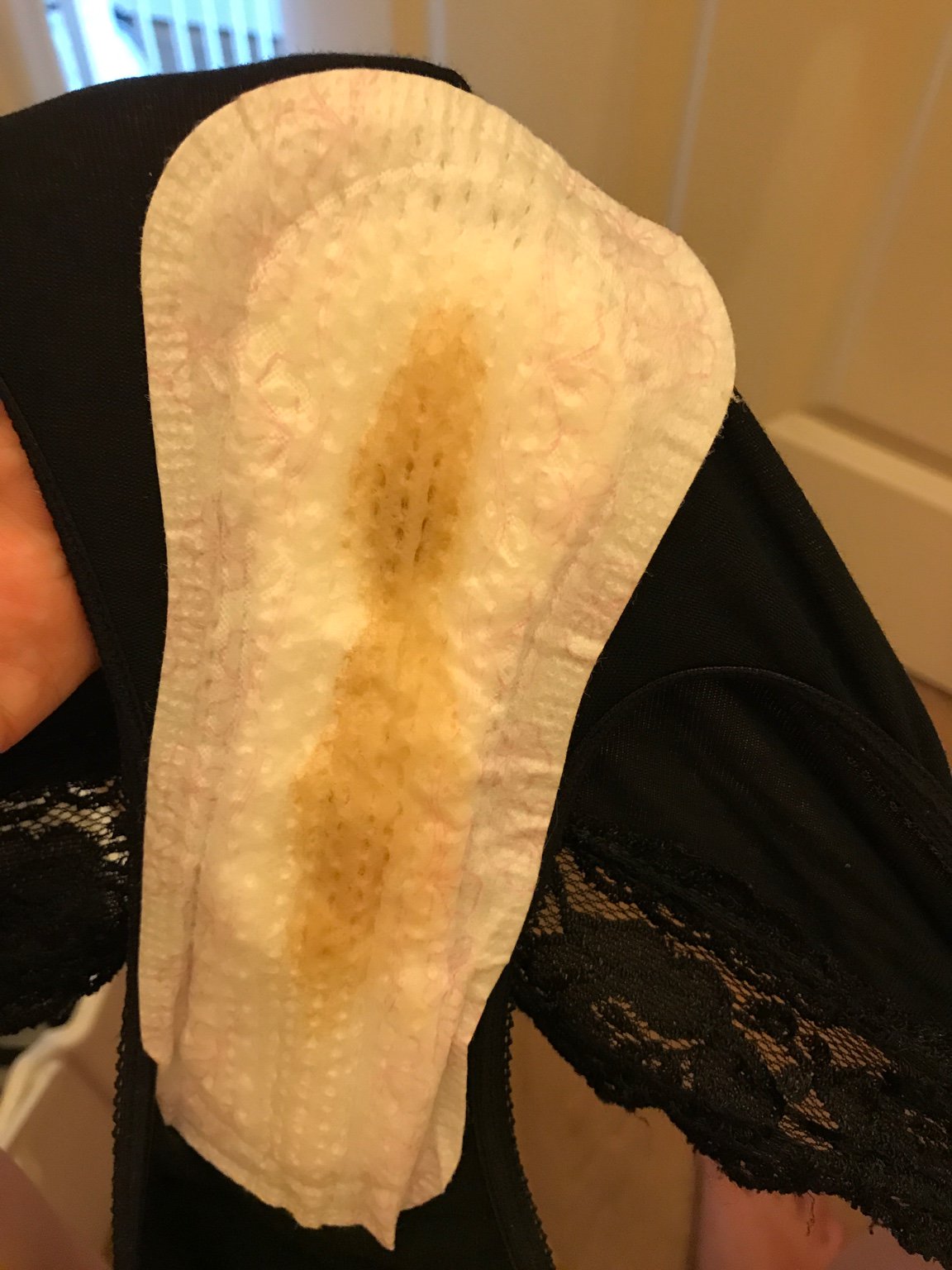 Advice of these pads! Sorry for the graphic images