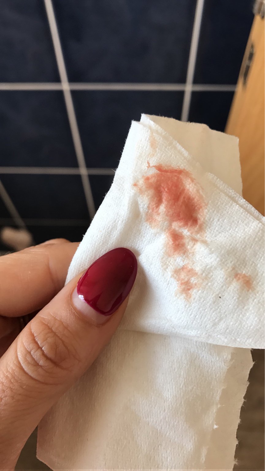 7 Weeks Bleeding Spotting Help