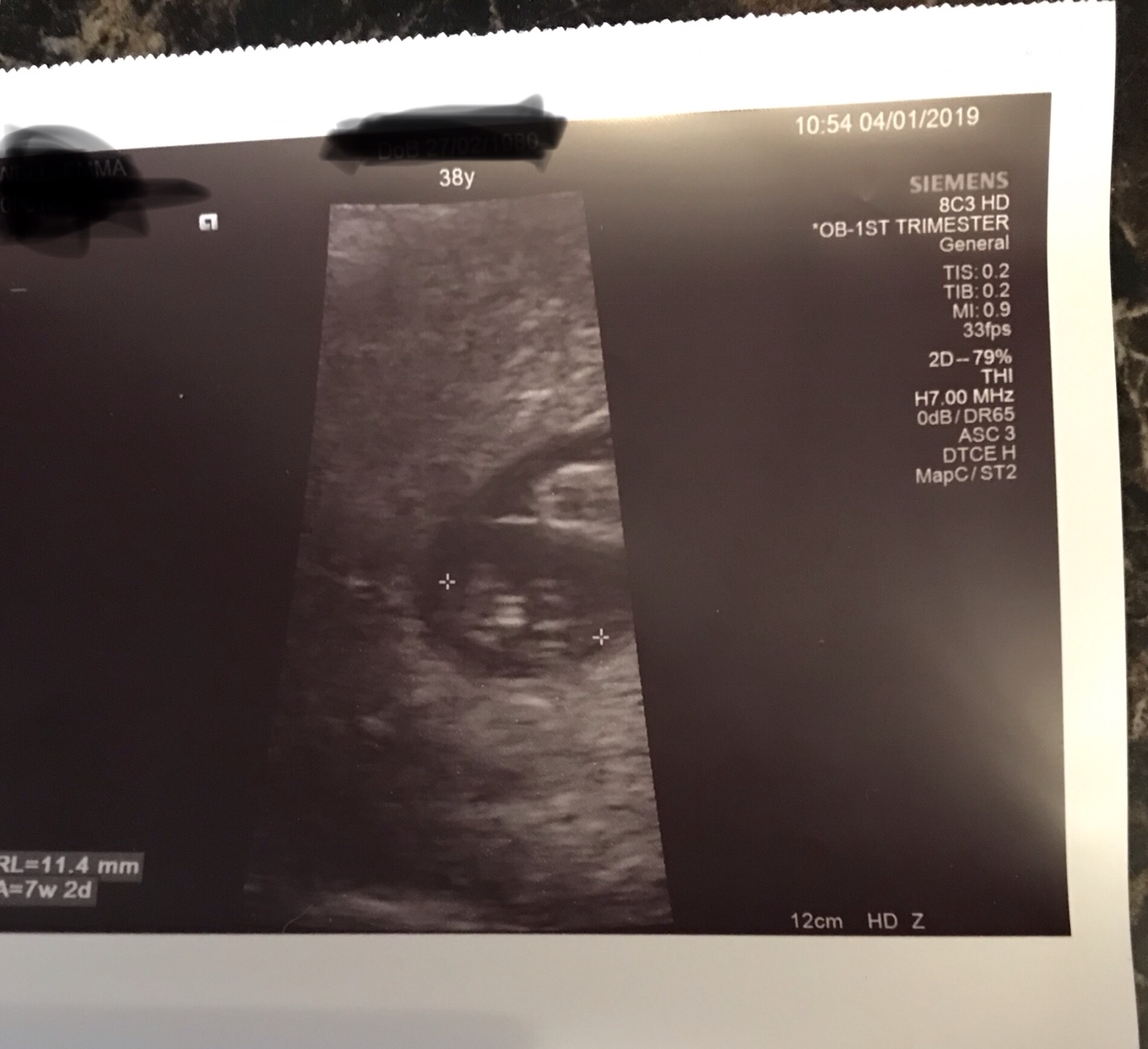 No yolk sac at 5+1 weeks pregnant?